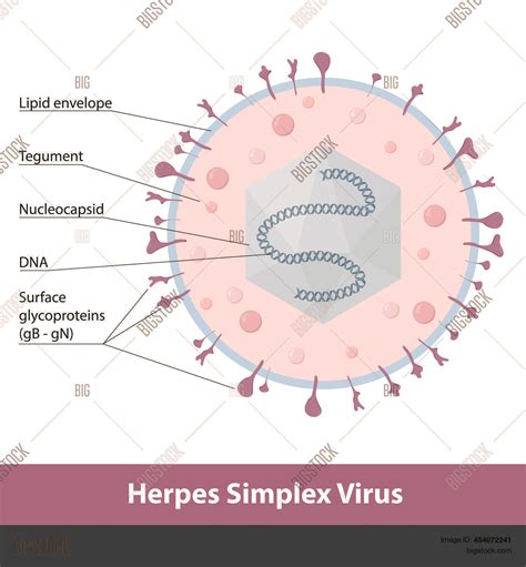 Herpes Simplex Virus
