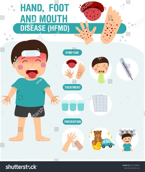 hfmd treatment