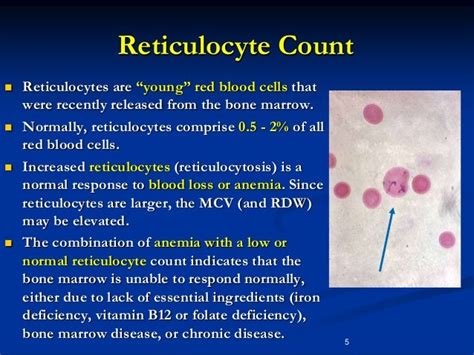 High Reticulocyte Count