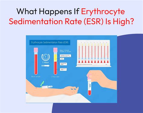 High Sedimentation Rate Causes