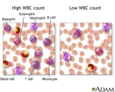 high white blood cell count