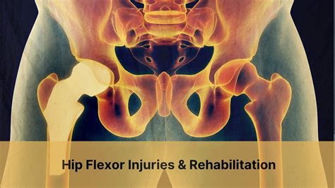 Hip Flexor Injuries