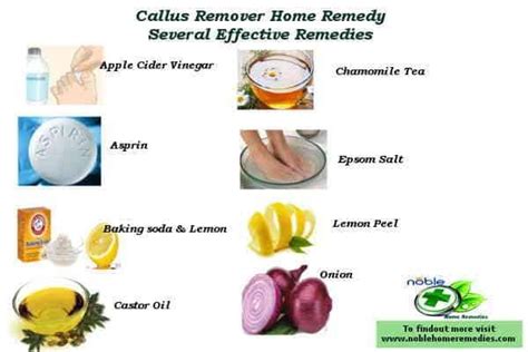 Home Remedies for Callus Removal