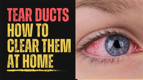 home remedies for clogged eye duct