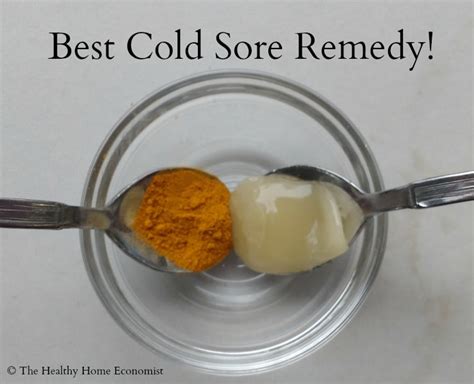 home remedies for cold sores