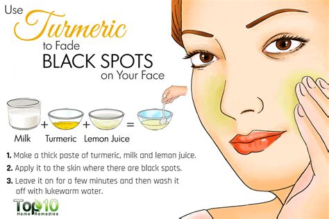 Home Remedies for Dark Spots