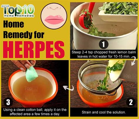 Home remedies for herpes on hands