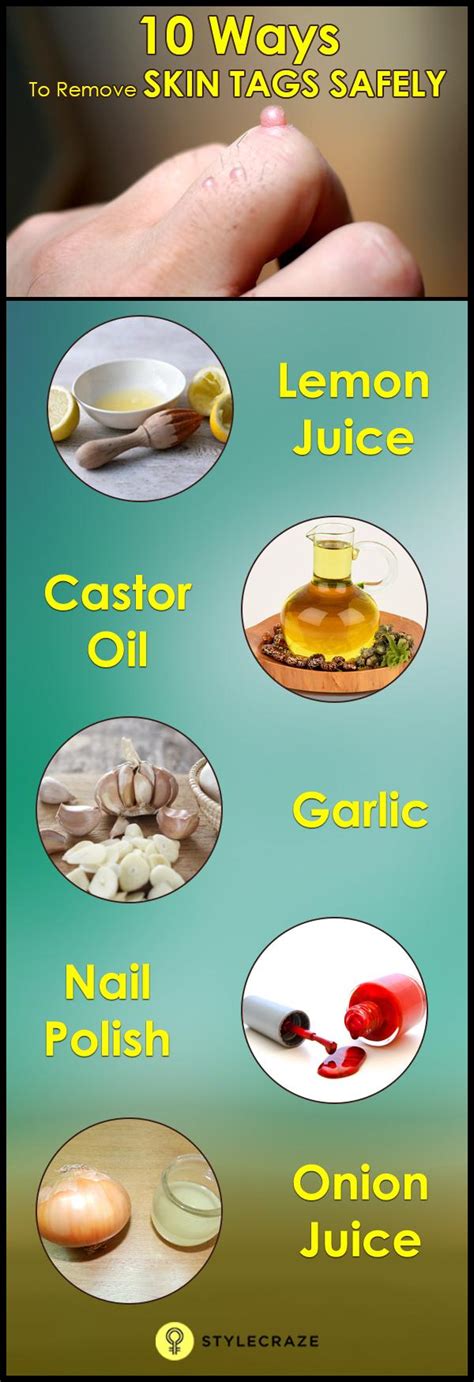 home remedies for skin tag removal