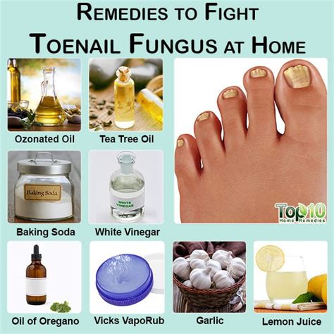 Home Remedies for Toenail Fungal Infections