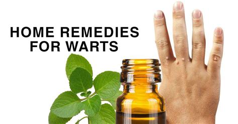 home remedies for warts