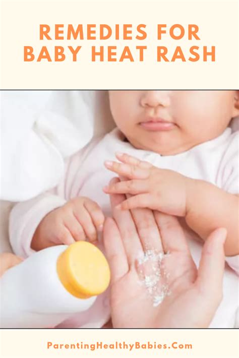 home remedies heat rash newborn