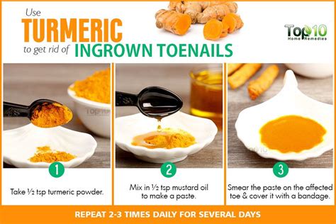 Home Remedies for Ingrown Nail