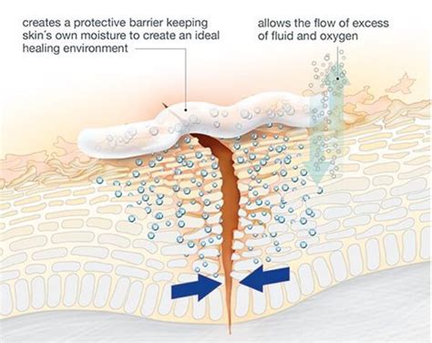 How Aquaphor Works