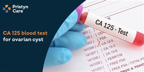 How CA 125 Blood Work is Used