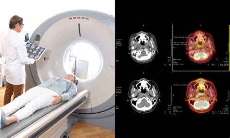 How CT scans work
