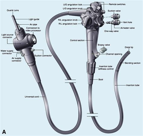 How Endoscopy Works