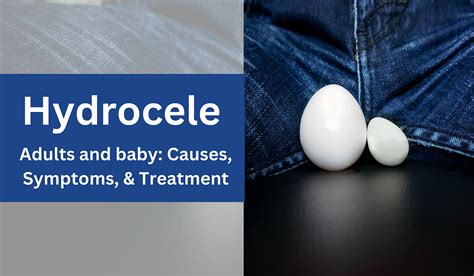 hydrocele symptoms