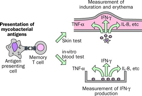 Immunological-Based TB Lab Test