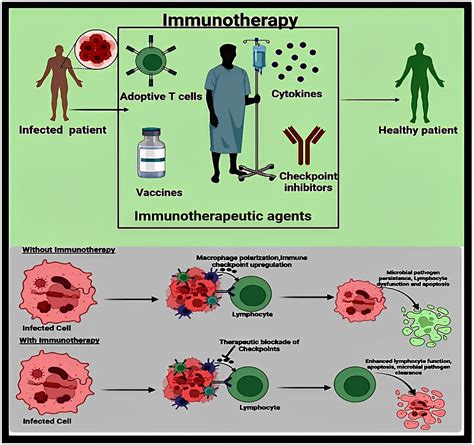 Immunotherapy for Allergies and Hay Fever