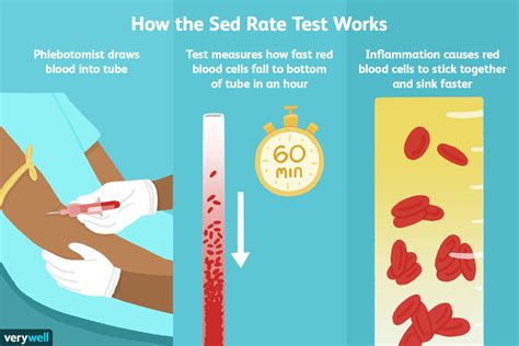 Importance of Monitoring Sedimentation Rate