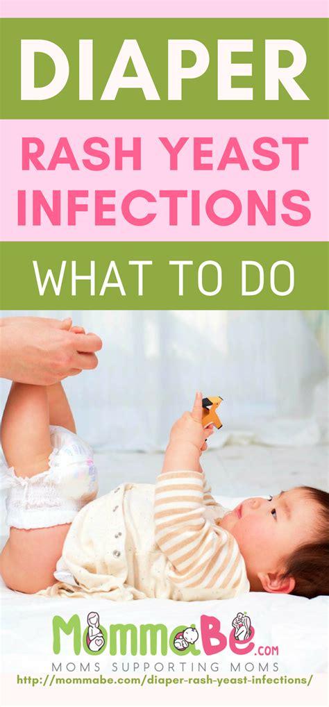 Infant Yeast Infection Prevention