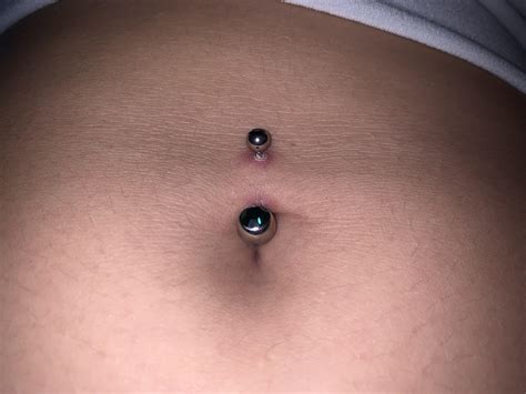 infected stomach piercing symptoms