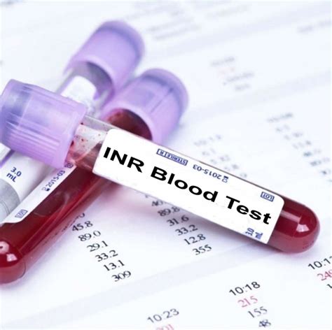 INR blood test
