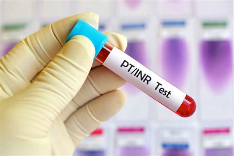 INR testing