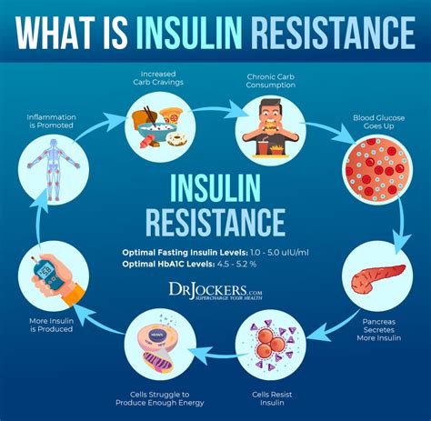 insulin resistance