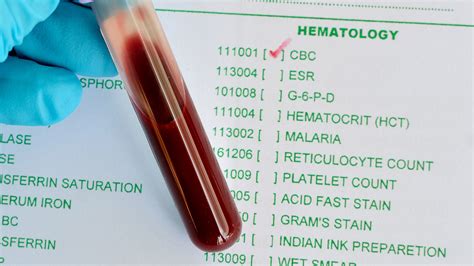 Interpreting blood count results