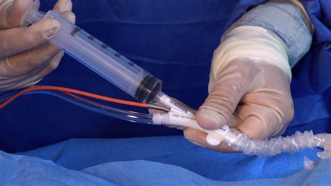 Intra-Aortic Balloon Pump Therapy