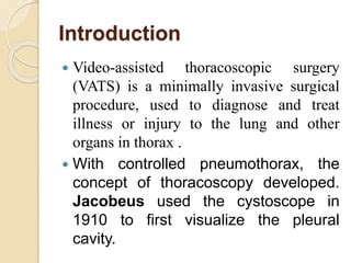 Introduction to the 5 Vats