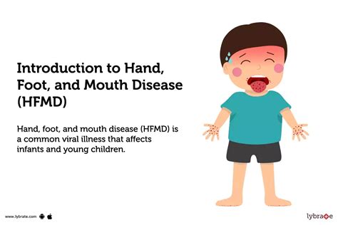 Introduction to Foot and Mouth Disease