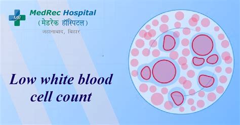 Introduction to Low Blood Cell Count