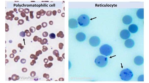 Introduction to Reticulocyte Count