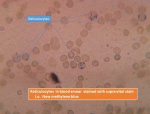 Introduction to Reticulocyte Count