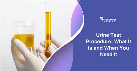 Introduction to Urine Test Results