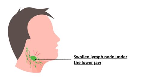 Jaw Lymph Nodes and Dental Health