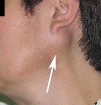 Jawline diagnosis and treatment
