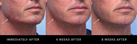 Jawline swelling causes