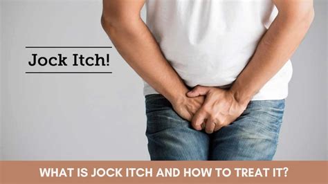 jock itch when to see a doctor