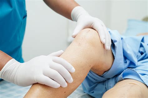 Joint Replacement Surgery