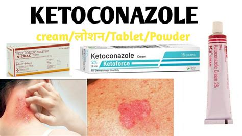 Ketoconazole Benefits