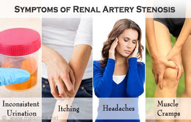 Kidney Artery Stenosis Symptoms