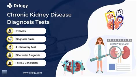 kidney disease diagnosis and treatment