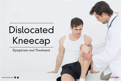 Knee Cap Dislocation Treatment