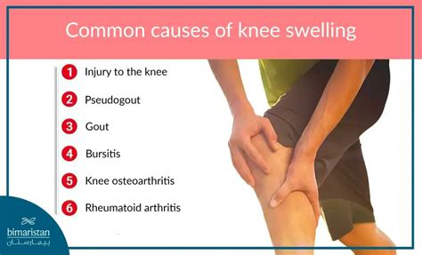 Knee effusion symptoms