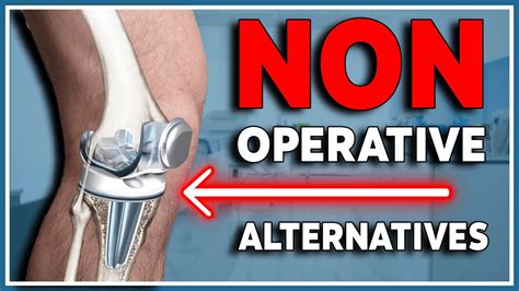 Knee Replacement Surgery Alternatives