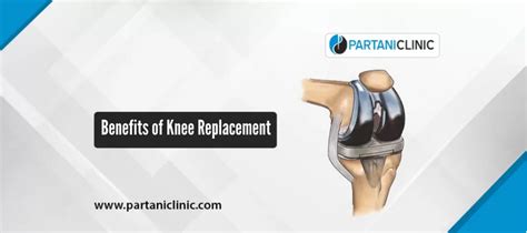 Knee Replacement Surgery Benefits