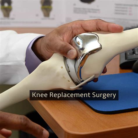 Knee Replacement Surgery Procedure